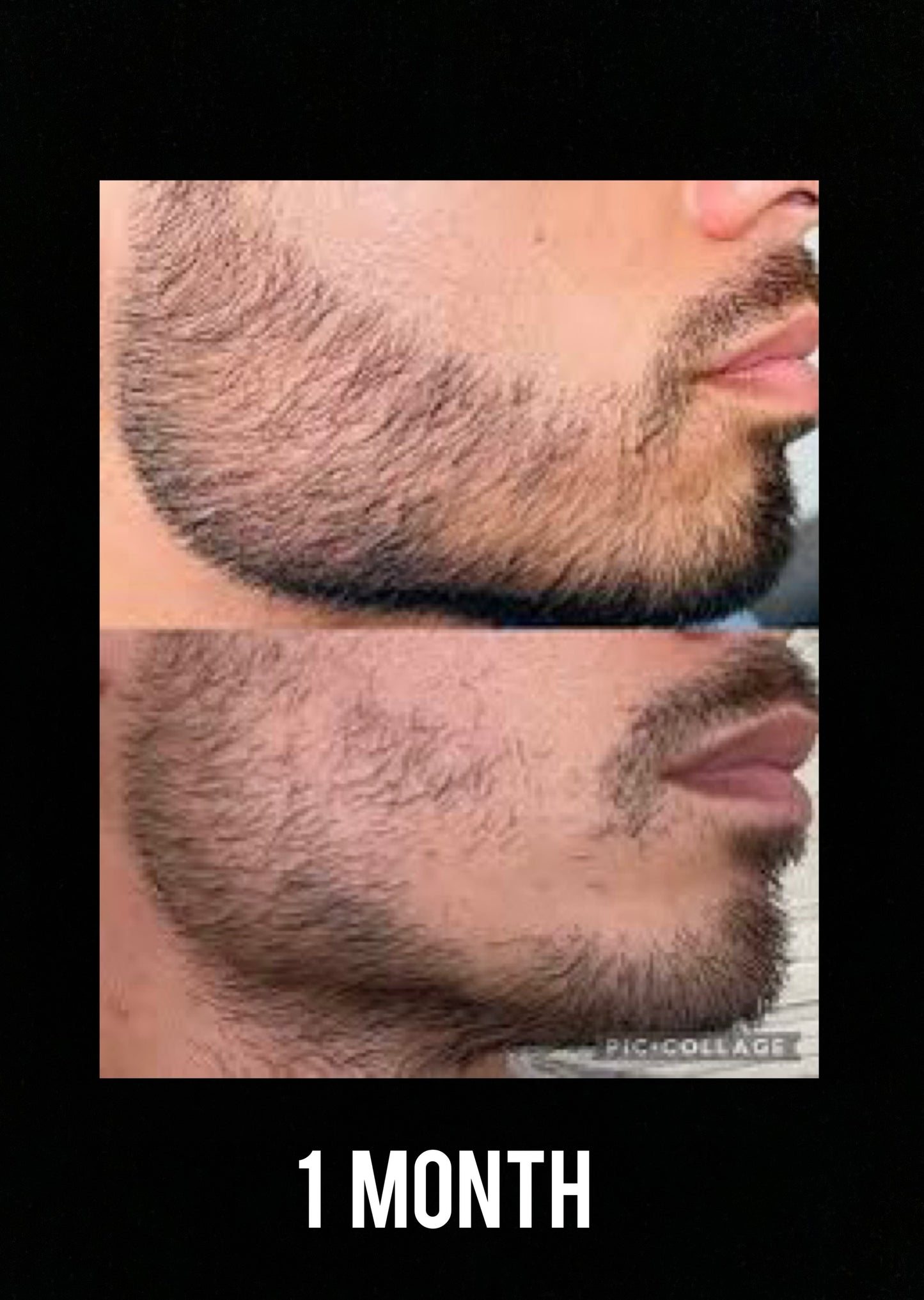 100% Proven Method: Beard Growing Formula  (Instant Download)