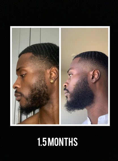 100% Proven Method: Beard Growing Formula  (Instant Download)