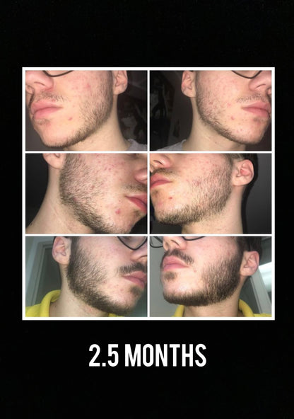 100% Proven Method: Beard Growing Formula  (Instant Download)