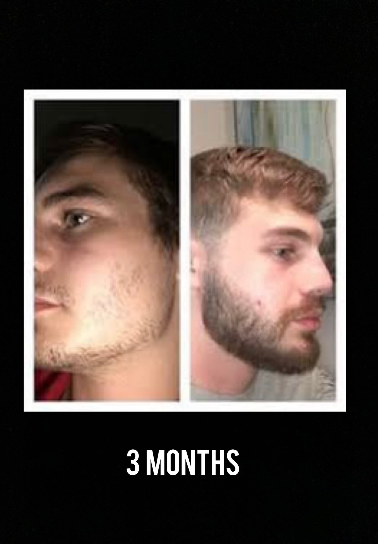 100% Proven Method: Beard Growing Formula  (Instant Download)